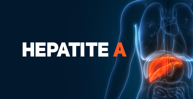 Saúde realiza busca ativa de casos de hepatite A para desenvolver estratégias